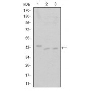 Western blot analysis using CDK9 antibody against Jurkat (1), A431 (2) and HEK293 (3) cell lysate.