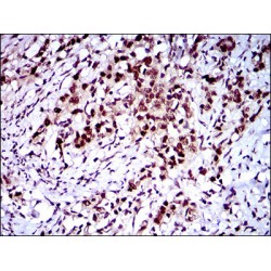 CASP8 And FADD Like Apoptosis Regulator (CFLAR) Antibody