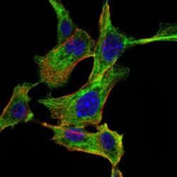 Inhibitor of Nuclear Factor Kappa-B Kinase Subunit Alpha / IKKA (CHUK) Antibody