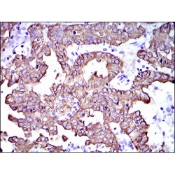 Keratin, Type II Cytoskeletal 5 (KRT5) Antibody