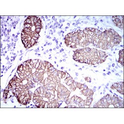 Keratin, Type II Cytoskeletal 5 (KRT5) Antibody