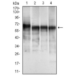 Keratin, Type II Cytoskeletal 5 (KRT5) Antibody