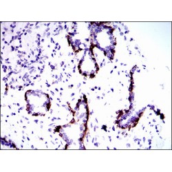 Keratin, Type II Cytoskeletal 5 (KRT5) Antibody