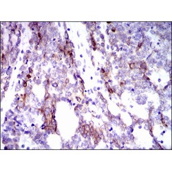 Keratin, Type II Cytoskeletal 5 (KRT5) Antibody