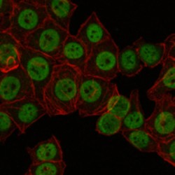 CREB Regulated Transcription Coactivator 3 (CRTC3) Antibody