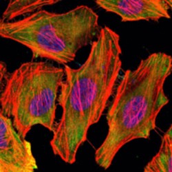 Tyrosine-Protein Kinase CSK (CSK) Antibody