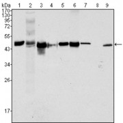Western blot analysis using CK18 antibody against Hela (1), NIH/3T3 (2), A549 (3), Jurkat (4), MCF-7 (5), HepG2 (6), A431 (7), HEK293 (8) and K562 (9) cell lysate.