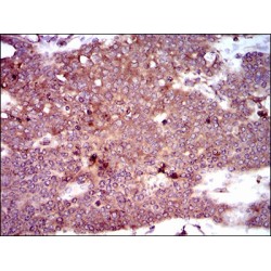 Dynactin Subunit 4 (DCTN4) Antibody