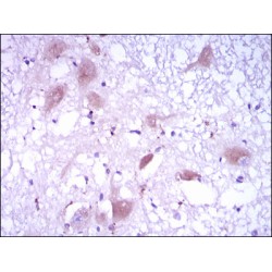 Dickkopf-Related Protein 3 (DKK3) Antibody