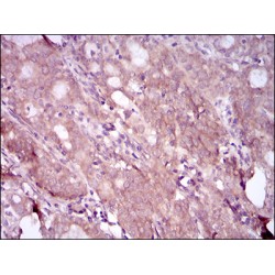 EGFR mutant Antibody