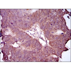 EGFR mutant Antibody