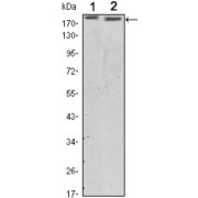 Western blot analysis using ERBB2 antibody against SKBR3 (1) and MCF-7 (2) cell lysate.