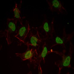 Estrogen Receptor (ESR1) Antibody