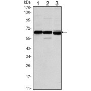abx015850