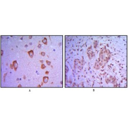 Protein C-Ets-1 (ETS1) Antibody