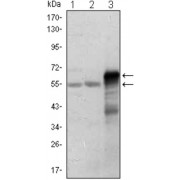 Western blot analysis using ETS1 antibody against Jurkat (1), HepG2 (2) and ETS1-hIgGFc transfected HEK293 (3) cell lysate.