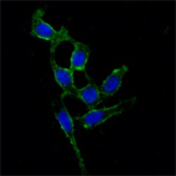 Protein Tyrosine Kinase 2 Beta (PTK2) Antibody