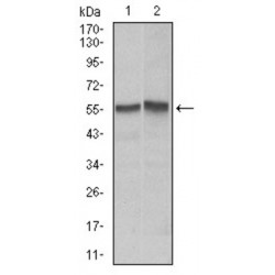TNF Receptor Superfamily Member 6 / CD95 / TNFRSF6 (FAS) Antibody