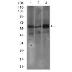 Fc Fragment of IgE, High Affinity I, Receptor (FCER1A) Antibody