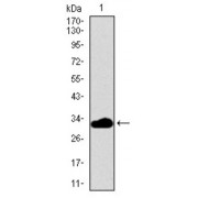 Western blot analysis using FCER1A antibody against human FCER1A recombinant protein. (Expected MW is 32.5 kDa).