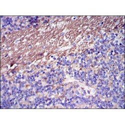 Fibrinogen Gamma (FGG) Antibody