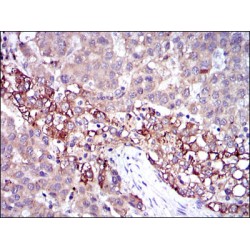 Fibrinogen Gamma (FGG) Antibody