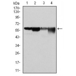 Glucose-6-Phosphate Dehydrogenase (G6PD) Antibody