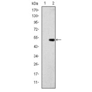 Western blot analysis using GCK antibody against human GCK (AA: 1-198) recombinant protein. (Expected MW is 48.2 kDa).