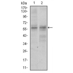 Guanine Nucleotide Binding Protein Like 3 (Nucleolar) (GNL3) Antibody