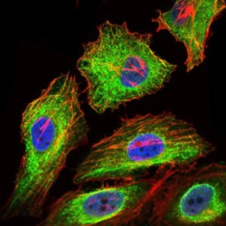 Glypican 3 (GPC3) Antibody