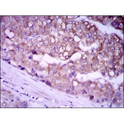 Glypican 3 (GPC3) Antibody