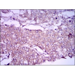 Glypican 3 (GPC3) Antibody