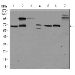 Glypican 3 (GPC3) Antibody