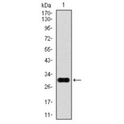 Western blot analysis using GPC3 antibody against human GPC3 recombinant protein (55-200 AA). Expected MW: 28.5 kDa.