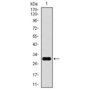 Western blot analysis using GPC3 antibody against human GPC3 recombinant protein (55-200 AA). Expected MW: 28.5 kDa.