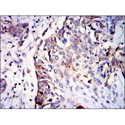 Glutathione S Transferase Mu 1 (GSTM1) Antibody