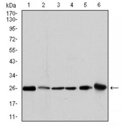 Glutathione S Transferase Mu 1 (GSTM1) Antibody