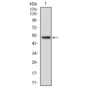 Western blot analysis using GSTM1 antibody against human GSTM1 (AA: 23-181) recombinant protein. (Expected MW is 25.7 kDa).