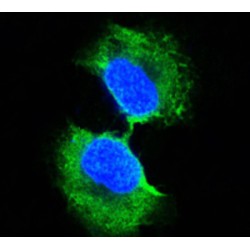 Glutathione S-Transferase P (GSTP1) Antibody