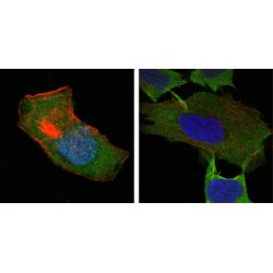 Glutathione S-Transferase P (GSTP1) Antibody