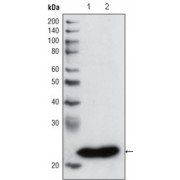 Western blot analysis using GSTP1 antibody against PC3 cell lysate (1) and human cerebellum tissue lysate (2).
