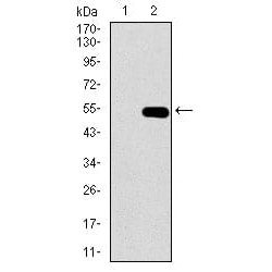 Guanylate Cyclase 1 Soluble Subunit Alpha 1 (GUCY1A1) Antibody