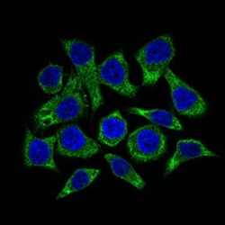 Guanylate Cyclase 1 Soluble Subunit Alpha 1 (GUCY1A1) Antibody