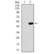 Western blot analysis using GUCY1A1/GUCY1A3 antibody against (1) non-transfected, and (2) GUCY1A1/GUCY1A3 (22-214 AA)-hIgGFc transfected HEK293 cell lysates.