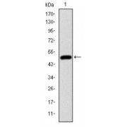 Western blot analysis using HFE antibody against human HFE (AA: 125-282) recombinant protein. (Expected MW is 44 kDa).