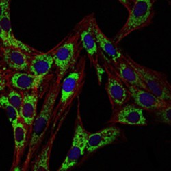 Heat Shock 60 kDa Protein 1, Chaperonin / HSP60 (HSPD1) Antibody