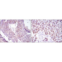Heat Shock 60 kDa Protein 1, Chaperonin / HSP60 (HSPD1) Antibody