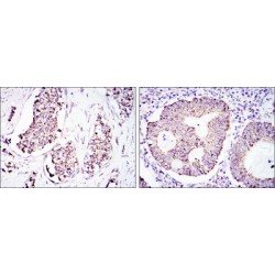 Heat Shock 60 kDa Protein 1, Chaperonin / HSP60 (HSPD1) Antibody
