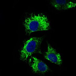 Interleukin 2 Receptor Alpha (IL2RA) Antibody