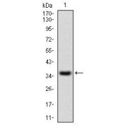 Western blot analysis using IL2RA antibody against human IL2RA recombinant protein. (Expected MW is 37.5 kDa).